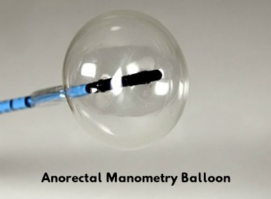 Anorectal Manometry Balloon Example
